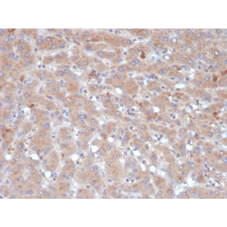 Immunohistochemistry - Anti-alpha 1 Antichymotrypsin Antibody [SERPINA3/4189] - BSA and Azide free (A278146) - Antibodies.com