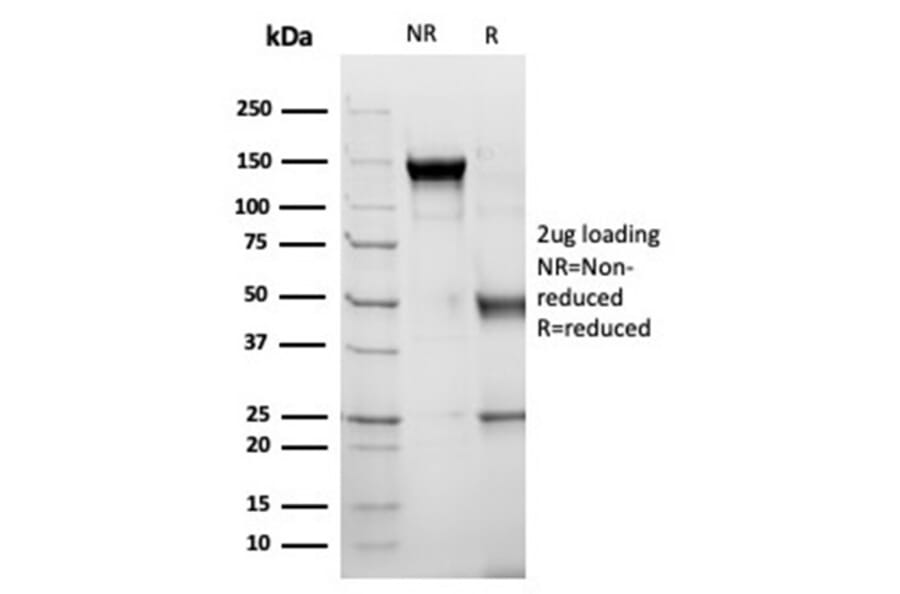 SDS-PAGE - Anti-alpha 1 Antichymotrypsin Antibody [SERPINA3/4189] - BSA and Azide free (A278146) - Antibodies.com