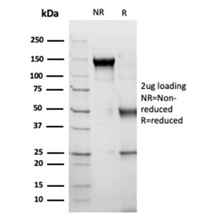 SDS-PAGE - Anti-alpha 1 Antichymotrypsin Antibody [SERPINA3/4189] - BSA and Azide free (A278146) - Antibodies.com