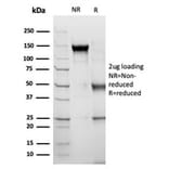 SDS-PAGE - Anti-alpha 1 Antichymotrypsin Antibody [SERPINA3/4189] - BSA and Azide free (A278146) - Antibodies.com