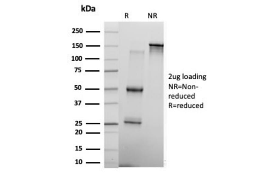 SDS-PAGE - Anti-KLF17 Antibody [PCRP-KLF17-1G2] - BSA and Azide free (A278147) - Antibodies.com