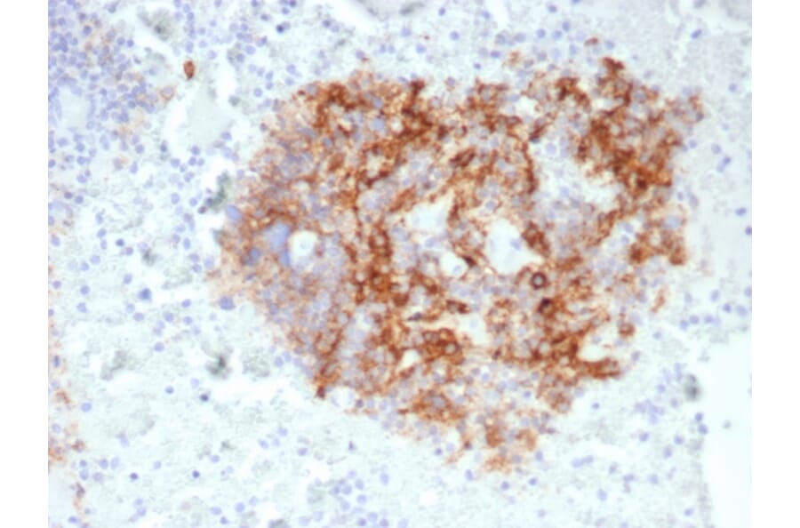Immunohistochemistry - Anti-CD35 Antibody [CR1/6380] - BSA and Azide free (A278148) - Antibodies.com