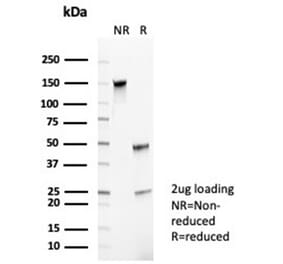 SDS-PAGE - Anti-CD35 Antibody [CR1/6385] - BSA and Azide free (A278150) - Antibodies.com