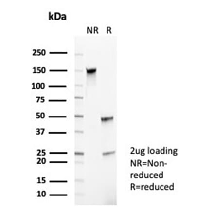 SDS-PAGE - Anti-CD35 Antibody [CR1/6385] - BSA and Azide free (A278150) - Antibodies.com