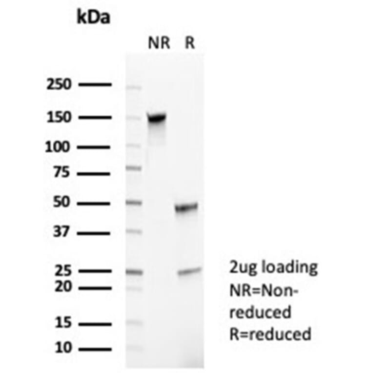 SDS-PAGE - Anti-CD35 Antibody [CR1/6385] - BSA and Azide free (A278150) - Antibodies.com