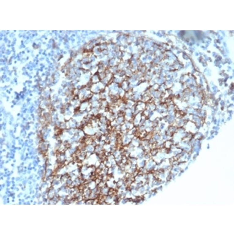 Immunohistochemistry - Anti-CD35 Antibody [CR1/6385] - BSA and Azide free (A278150) - Antibodies.com