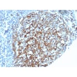 Immunohistochemistry - Anti-CD35 Antibody [CR1/6385] - BSA and Azide free (A278150) - Antibodies.com