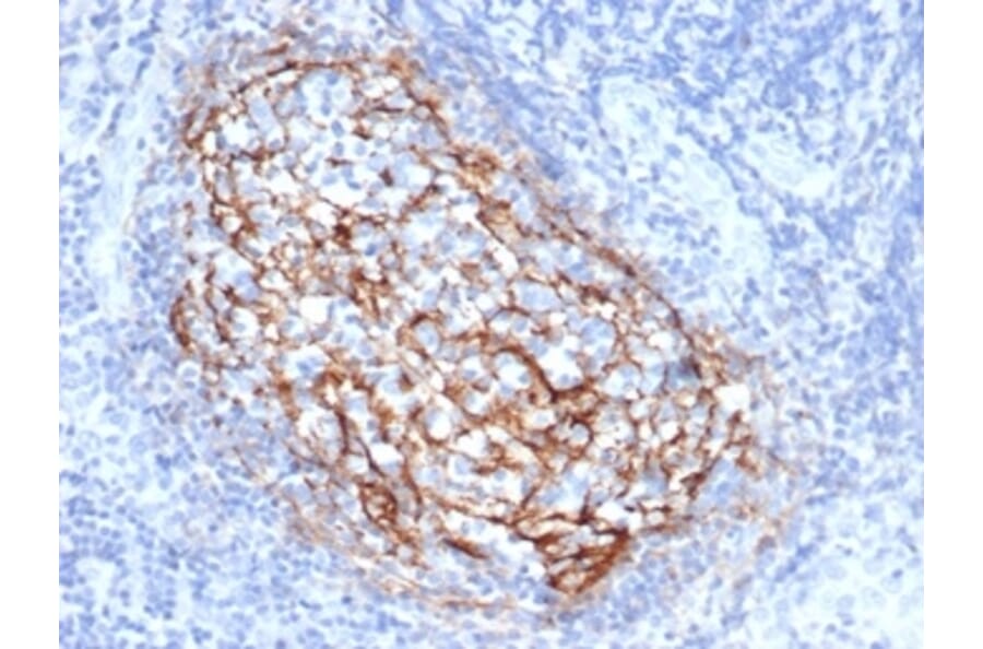 Immunohistochemistry - Anti-CD35 Antibody [CR1/6385] - BSA and Azide free (A278150) - Antibodies.com