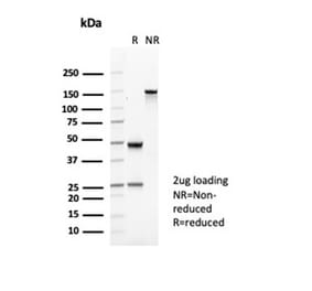 SDS-PAGE - Anti-CD35 Antibody [CR1/6377] - BSA and Azide free (A278151) - Antibodies.com