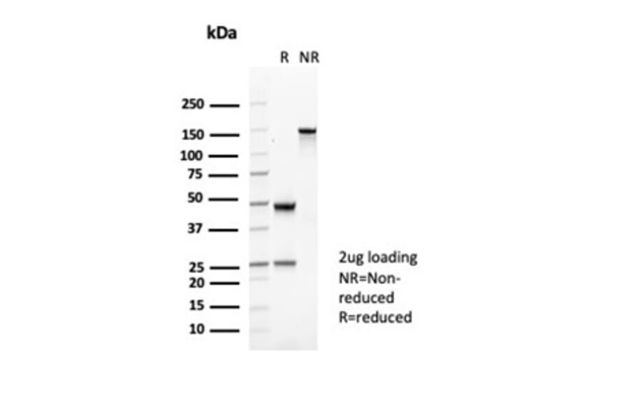 SDS-PAGE - Anti-CD35 Antibody [CR1/6377] - BSA and Azide free (A278151) - Antibodies.com