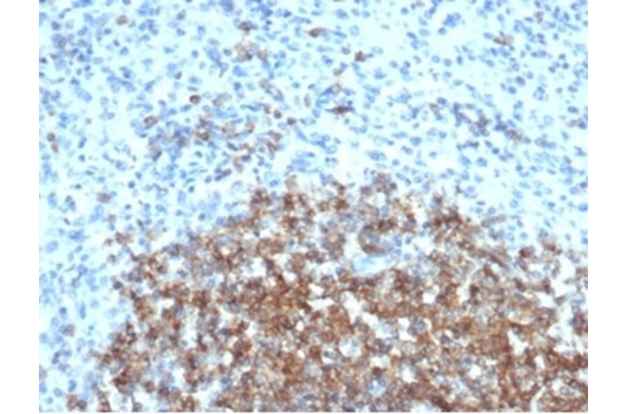Immunohistochemistry - Anti-CD35 Antibody [CR1/6377] - BSA and Azide free (A278151) - Antibodies.com