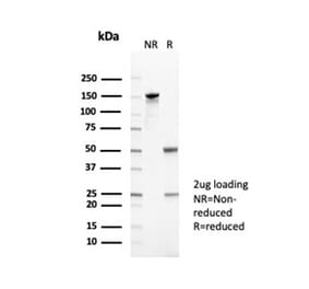 SDS-PAGE - Anti-CD35 Antibody [CR1/6378] - BSA and Azide free (A278152) - Antibodies.com