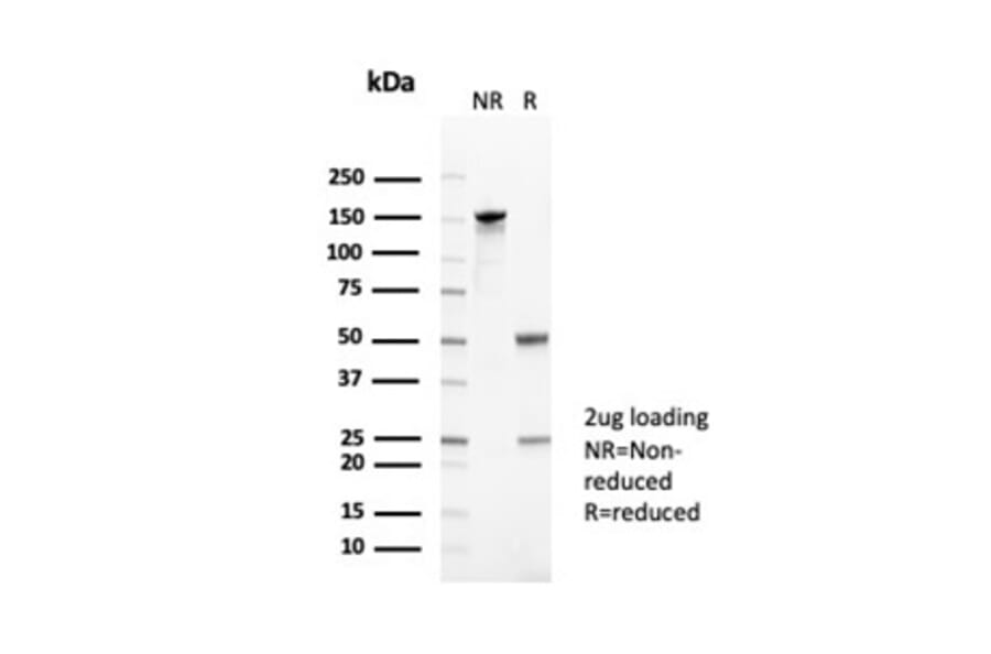 SDS-PAGE - Anti-CD35 Antibody [CR1/6378] - BSA and Azide free (A278152) - Antibodies.com