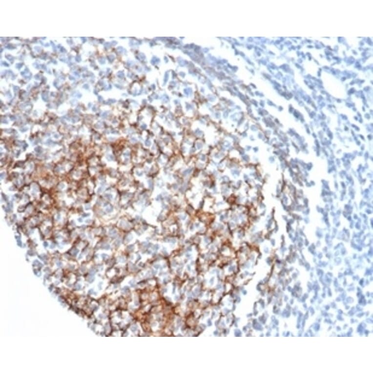 Immunohistochemistry - Anti-CD35 Antibody [CR1/6378] - BSA and Azide free (A278152) - Antibodies.com