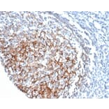 Immunohistochemistry - Anti-CD35 Antibody [CR1/6378] - BSA and Azide free (A278152) - Antibodies.com