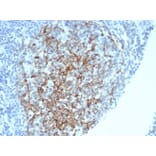 Immunohistochemistry - Anti-CD35 Antibody [CR1/6378] - BSA and Azide free (A278152) - Antibodies.com