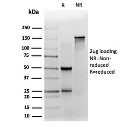 SDS-PAGE - Anti-ZNF358 Antibody [PCRP-ZNF358-1A6] - BSA and Azide free (A278154) - Antibodies.com