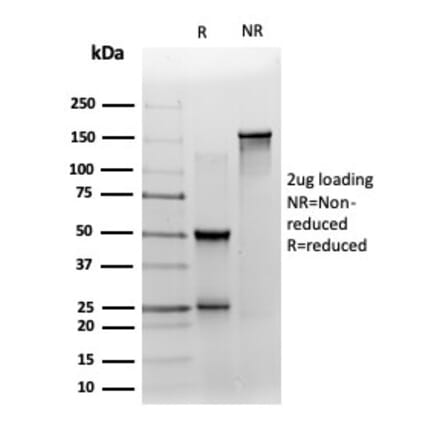 SDS-PAGE - Anti-ZNF358 Antibody [PCRP-ZNF358-1A6] - BSA and Azide free (A278154) - Antibodies.com