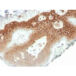 Immunohistochemistry - Anti-delta 1 Catenin Antibody [CTNND1/4501] - BSA and Azide free (A278155) - Antibodies.com