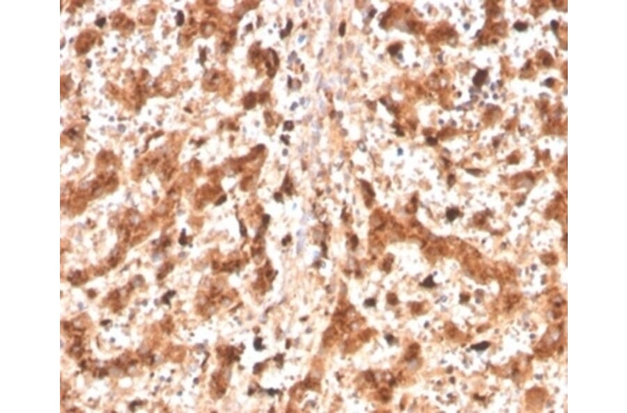 Immunohistochemistry - Anti-Cathepsin D Antibody [CTSD/4497] - BSA and Azide free (A278157) - Antibodies.com