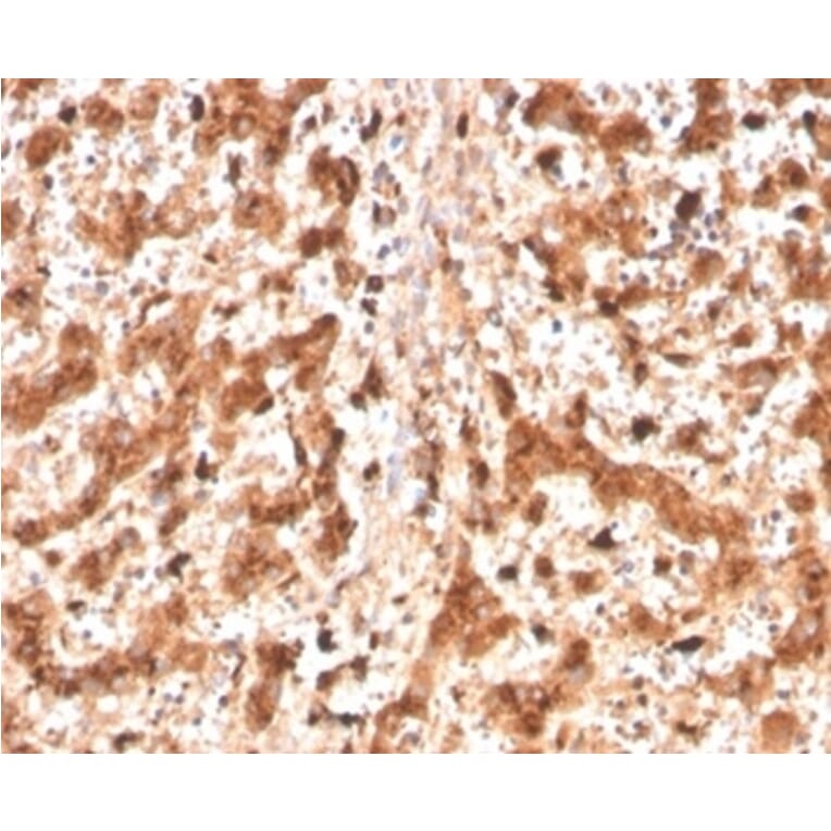 Immunohistochemistry - Anti-Cathepsin D Antibody [CTSD/4497] - BSA and Azide free (A278157) - Antibodies.com