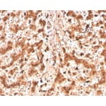 Immunohistochemistry - Anti-Cathepsin D Antibody [CTSD/4497] - BSA and Azide free (A278157) - Antibodies.com