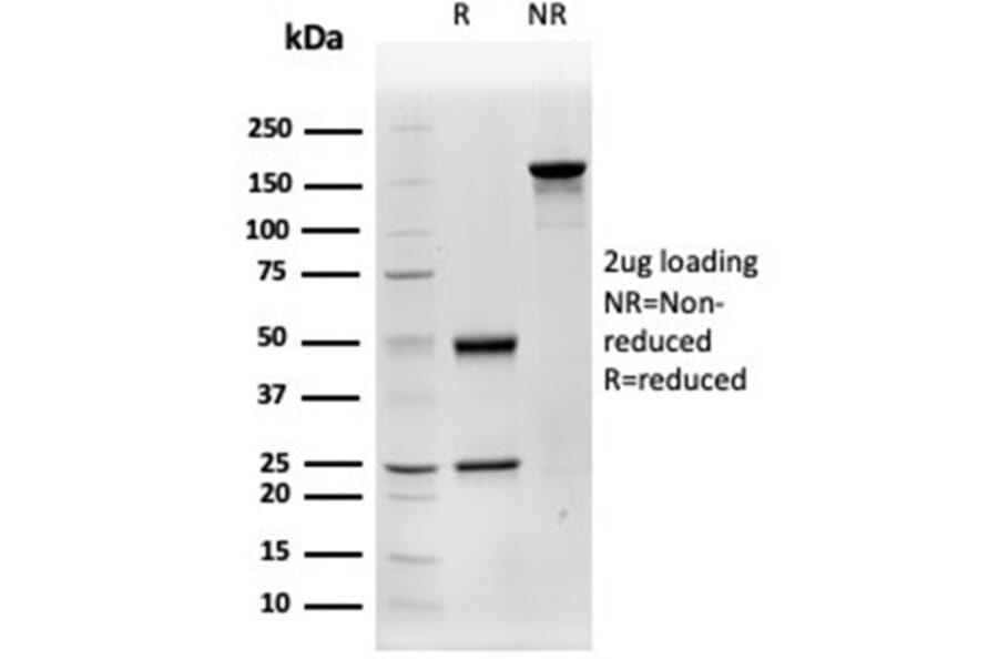 SDS-PAGE - Anti-Cathepsin D Antibody [CTSD/4497] - BSA and Azide free (A278157) - Antibodies.com