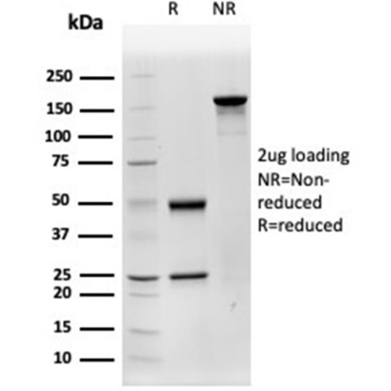 SDS-PAGE - Anti-Cathepsin D Antibody [CTSD/4497] - BSA and Azide free (A278157) - Antibodies.com