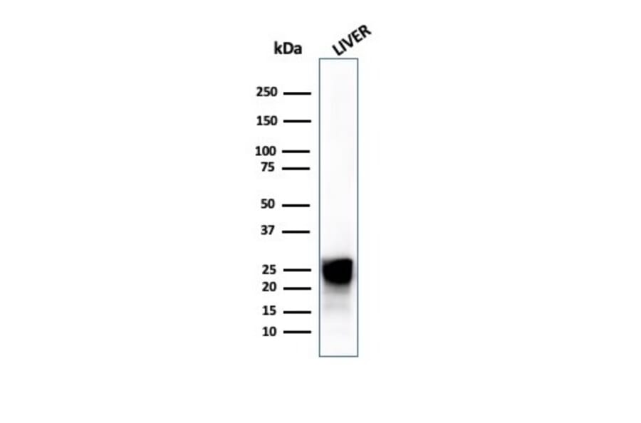 Western Blot - Anti-Cathepsin D Antibody [CTSD/4497] - BSA and Azide free (A278157) - Antibodies.com