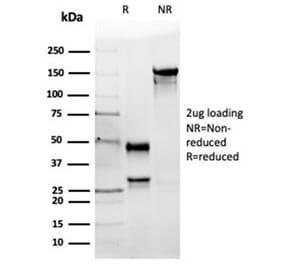 SDS-PAGE - Anti-Angiotensin Converting Enzyme 1 Antibody [ACE/3764] - BSA and Azide free (A278162) - Antibodies.com