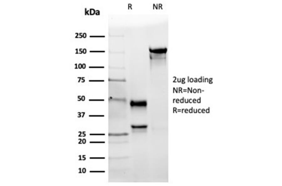 SDS-PAGE - Anti-Angiotensin Converting Enzyme 1 Antibody [ACE/3764] - BSA and Azide free (A278162) - Antibodies.com