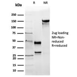 SDS-PAGE - Anti-Angiotensin Converting Enzyme 1 Antibody [ACE/3764] - BSA and Azide free (A278162) - Antibodies.com