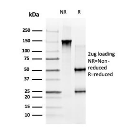 SDS-PAGE - Anti-GLIS3 Antibody [PCRP-GLIS3-1B11] - BSA and Azide free (A278167) - Antibodies.com