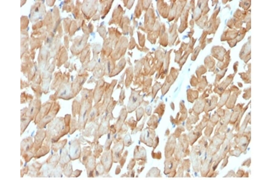 Immunohistochemistry - Anti-Dystrophin Antibody [DMD/3676] - BSA and Azide free (A278168) - Antibodies.com