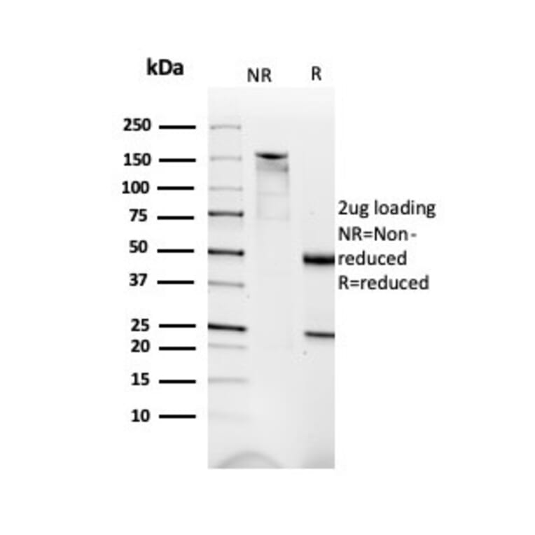 SDS-PAGE - Anti-Dystrophin Antibody [DMD/3676] - BSA and Azide free (A278168) - Antibodies.com