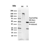 SDS-PAGE - Anti-Dystrophin Antibody [DMD/3676] - BSA and Azide free (A278168) - Antibodies.com