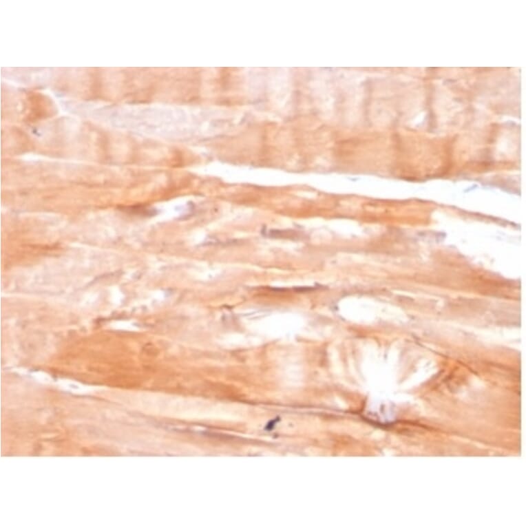 Immunohistochemistry - Anti-Dystrophin Antibody [DMD/3676] - BSA and Azide free (A278168) - Antibodies.com