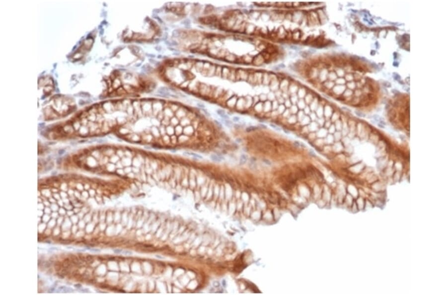 Immunohistochemistry - Anti-Reelin Antibody [RELN/4498] - BSA and Azide free (A278170) - Antibodies.com