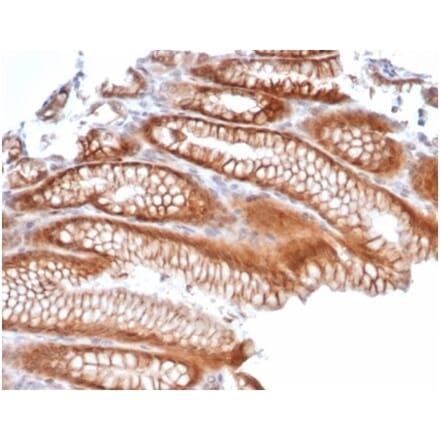 Immunohistochemistry - Anti-Reelin Antibody [RELN/4498] - BSA and Azide free (A278170) - Antibodies.com