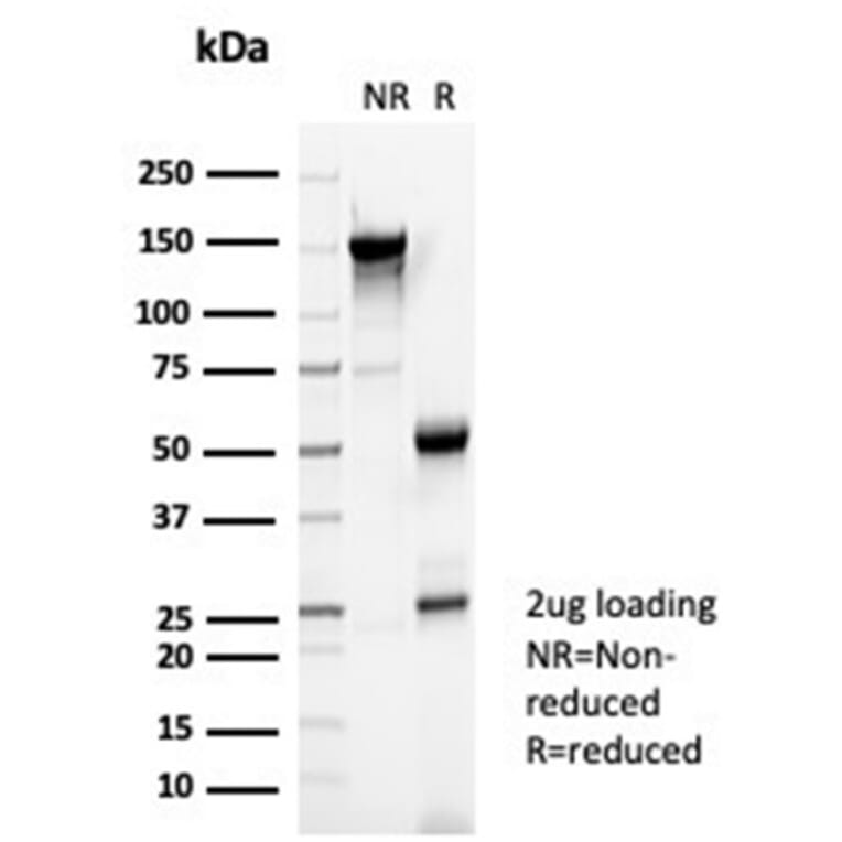 SDS-PAGE - Anti-Reelin Antibody [RELN/4498] - BSA and Azide free (A278170) - Antibodies.com