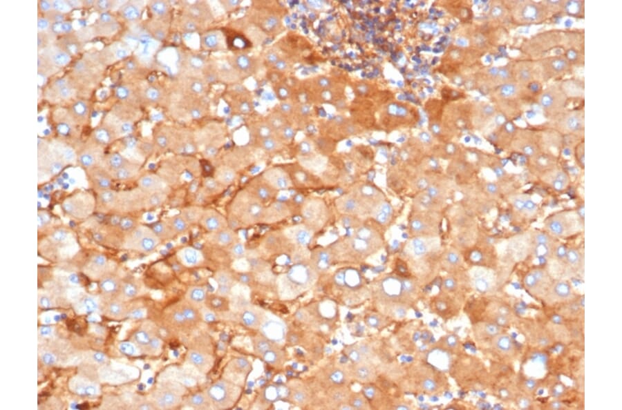 Immunohistochemistry - Anti-alpha 2 Macroglobulin Antibody [A2M/3622] - BSA and Azide free (A278172) - Antibodies.com