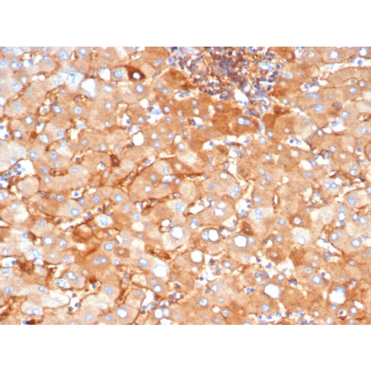 Immunohistochemistry - Anti-alpha 2 Macroglobulin Antibody [A2M/3622] - BSA and Azide free (A278172) - Antibodies.com