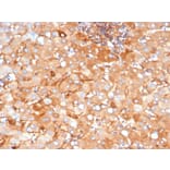 Immunohistochemistry - Anti-alpha 2 Macroglobulin Antibody [A2M/3622] - BSA and Azide free (A278172) - Antibodies.com