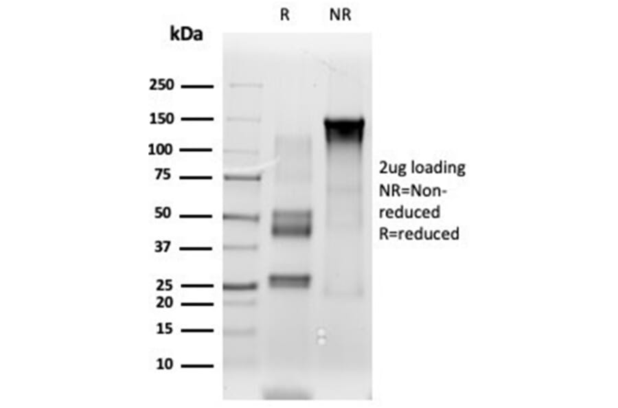 SDS-PAGE - Anti-ETS2 Antibody [PCRP-ETS2-1D9] - BSA and Azide free (A278173) - Antibodies.com