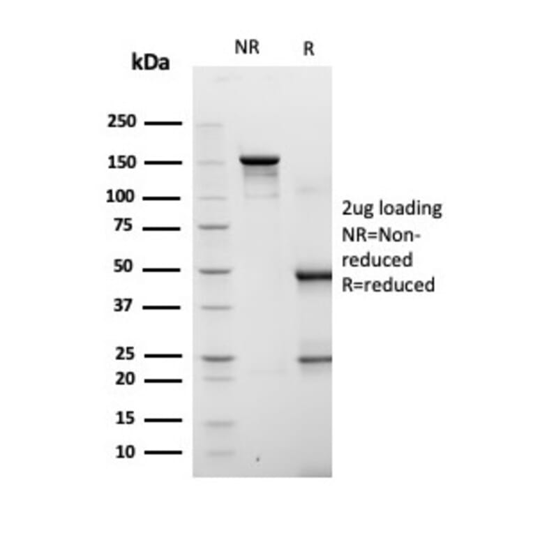 SDS-PAGE - Anti-FABP4 Antibody [FABP4/4422] - BSA and Azide free (A278174) - Antibodies.com