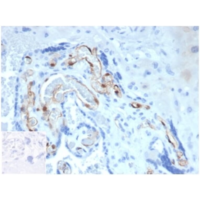 Immunohistochemistry - Anti-FABP4 Antibody [FABP4/4424] - BSA and Azide free (A278176) - Antibodies.com