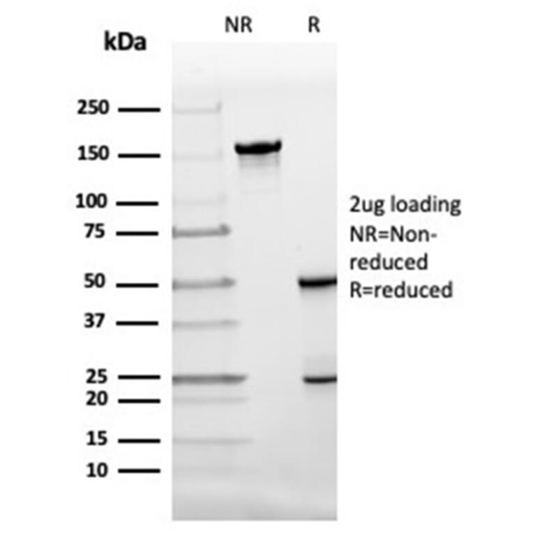 SDS-PAGE - Anti-FABP4 Antibody [FABP4/4424] - BSA and Azide free (A278176) - Antibodies.com