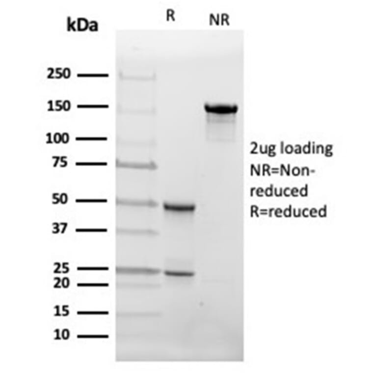 SDS-PAGE - Anti-FABP4 Antibody [FABP4/4426] - BSA and Azide free (A278177) - Antibodies.com