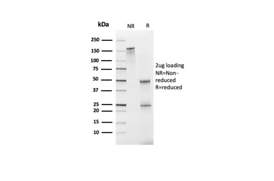 SDS-PAGE - Anti-FABP1 Antibody [FABP1/3940] - BSA and Azide free (A278179) - Antibodies.com
