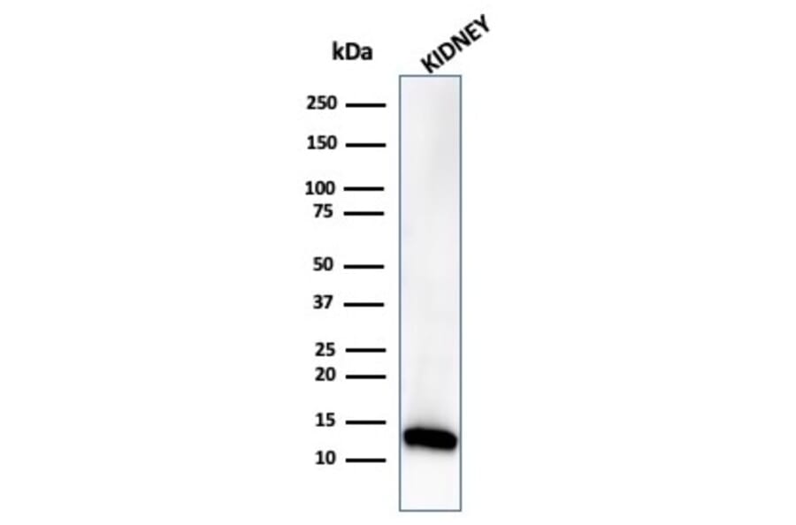 Western Blot - Anti-FABP1 Antibody [FABP1/3485] - BSA and Azide free (A278180) - Antibodies.com